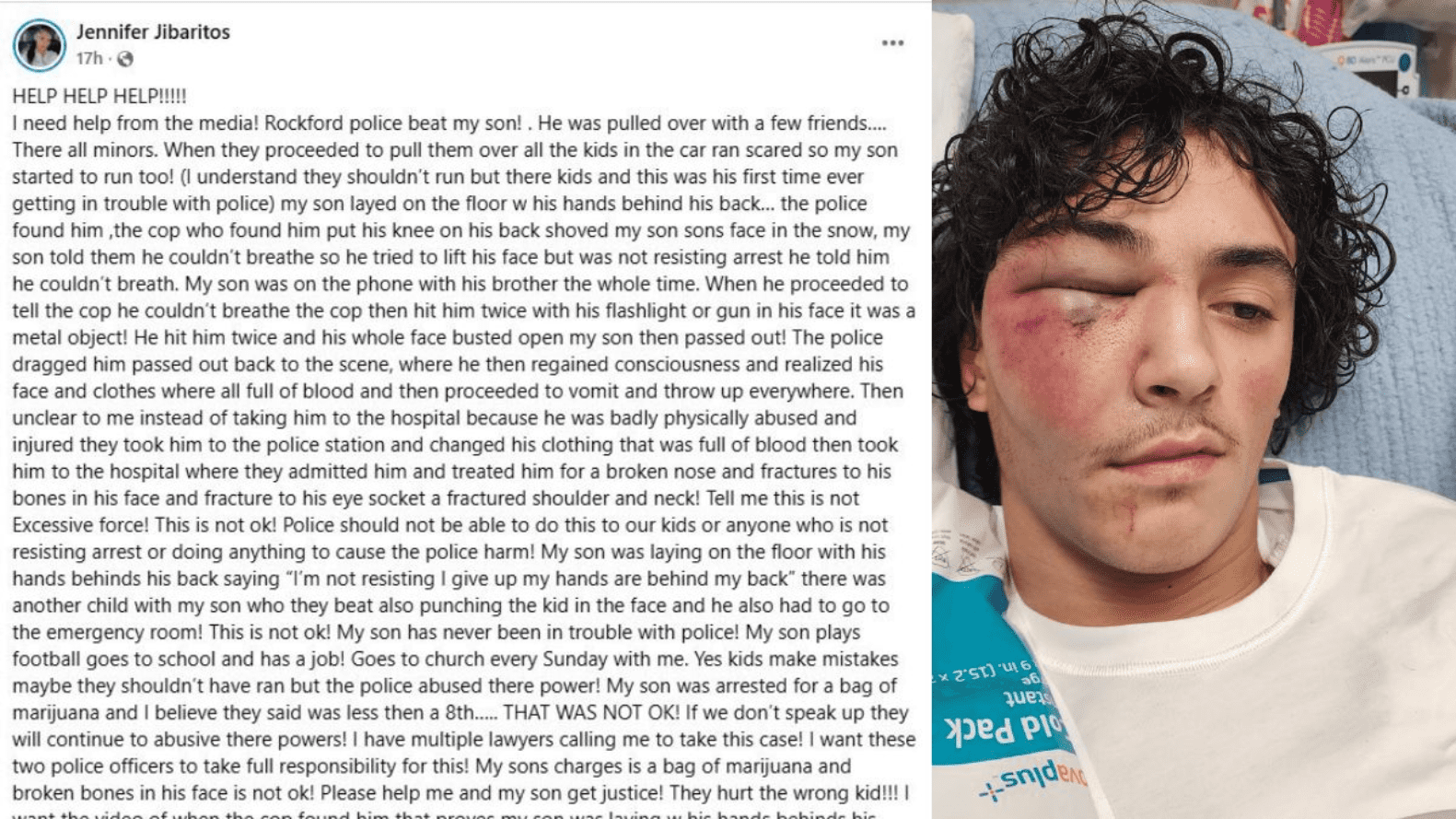 Rockford Police Accused Of Beating Teen Football Player Over A Tiny Amount Of Marijuana